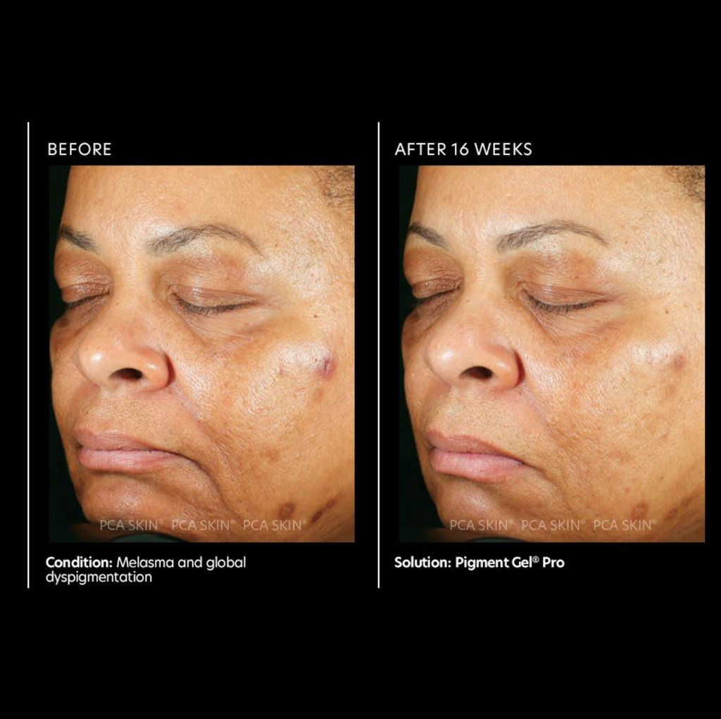Pigment Gel Pro