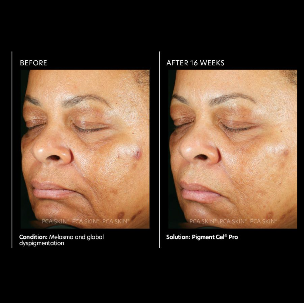 Pigment Gel Pro