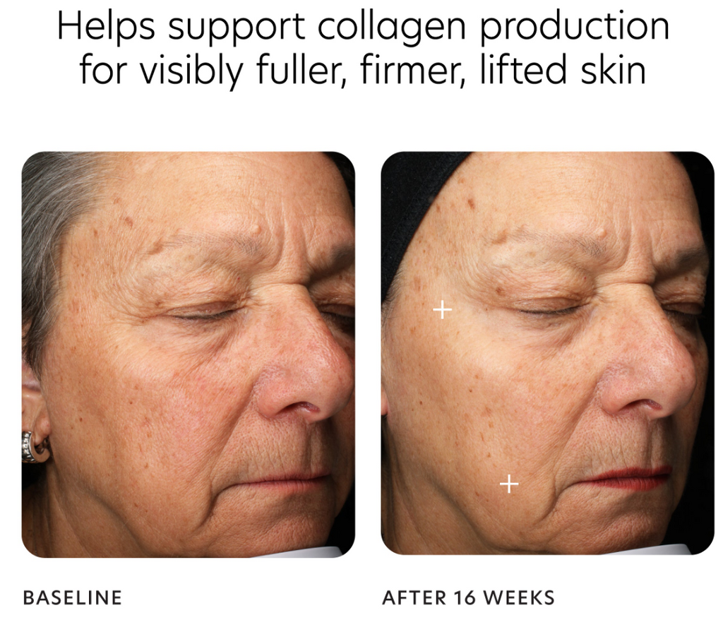 PCA Skin MGF Age Renewal Cream — skin benefits and results