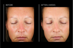 Hyaluronic Acid Overnight Mask
