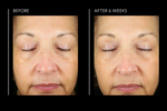 Hyaluronic Acid Overnight Mask